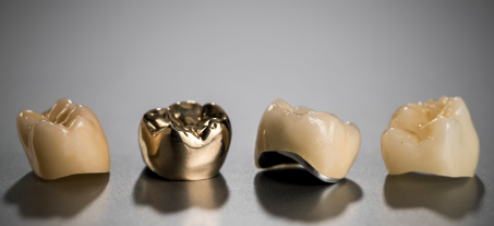 Range of dental crown types by Andent Dental Lab