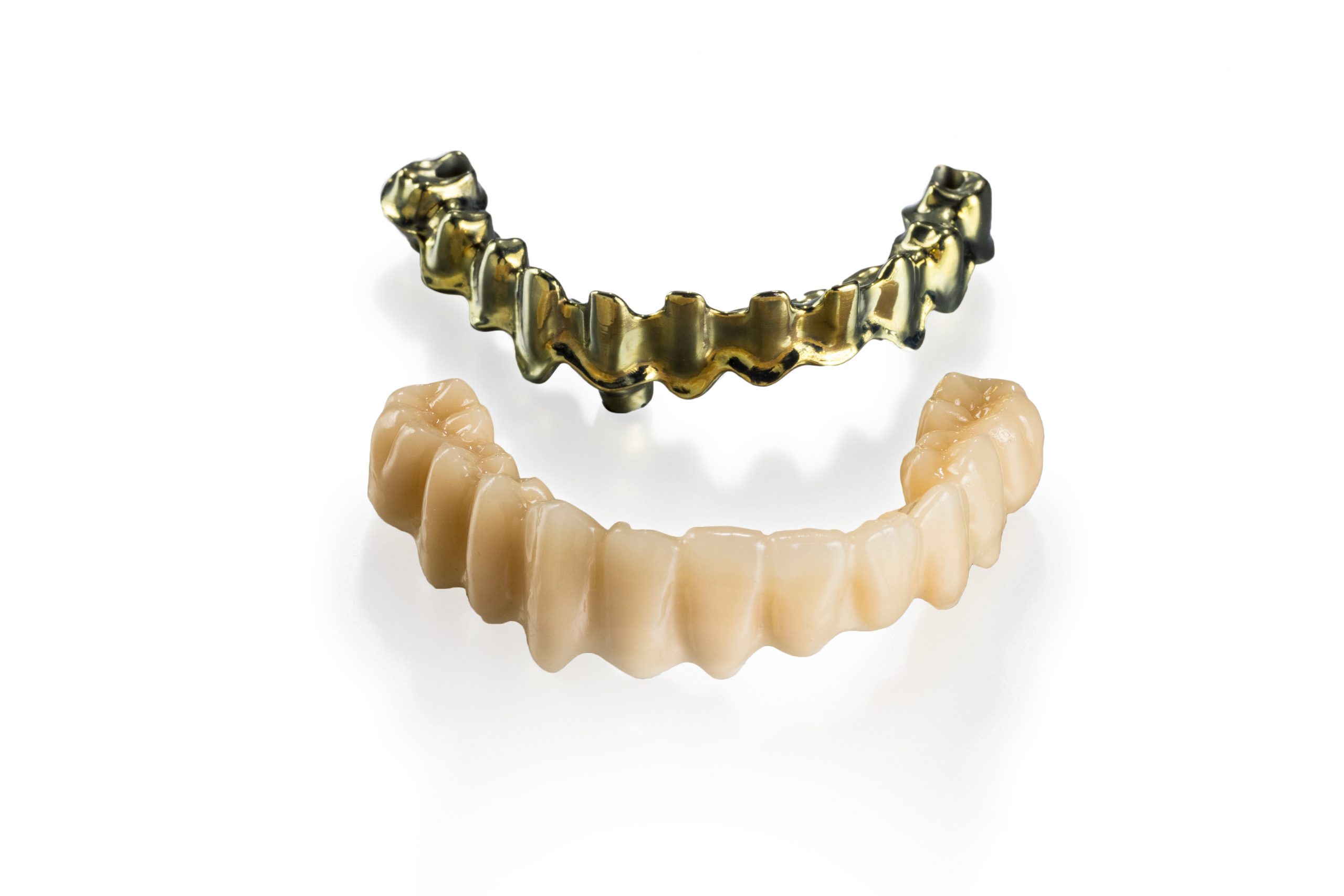 Hybrid PMMA Implant Restoration | Andent Dental Laboratory