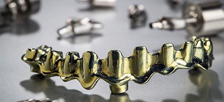 Implant Solutions - Andent Dental Laboratory’s Hybrid PMMA Implant
