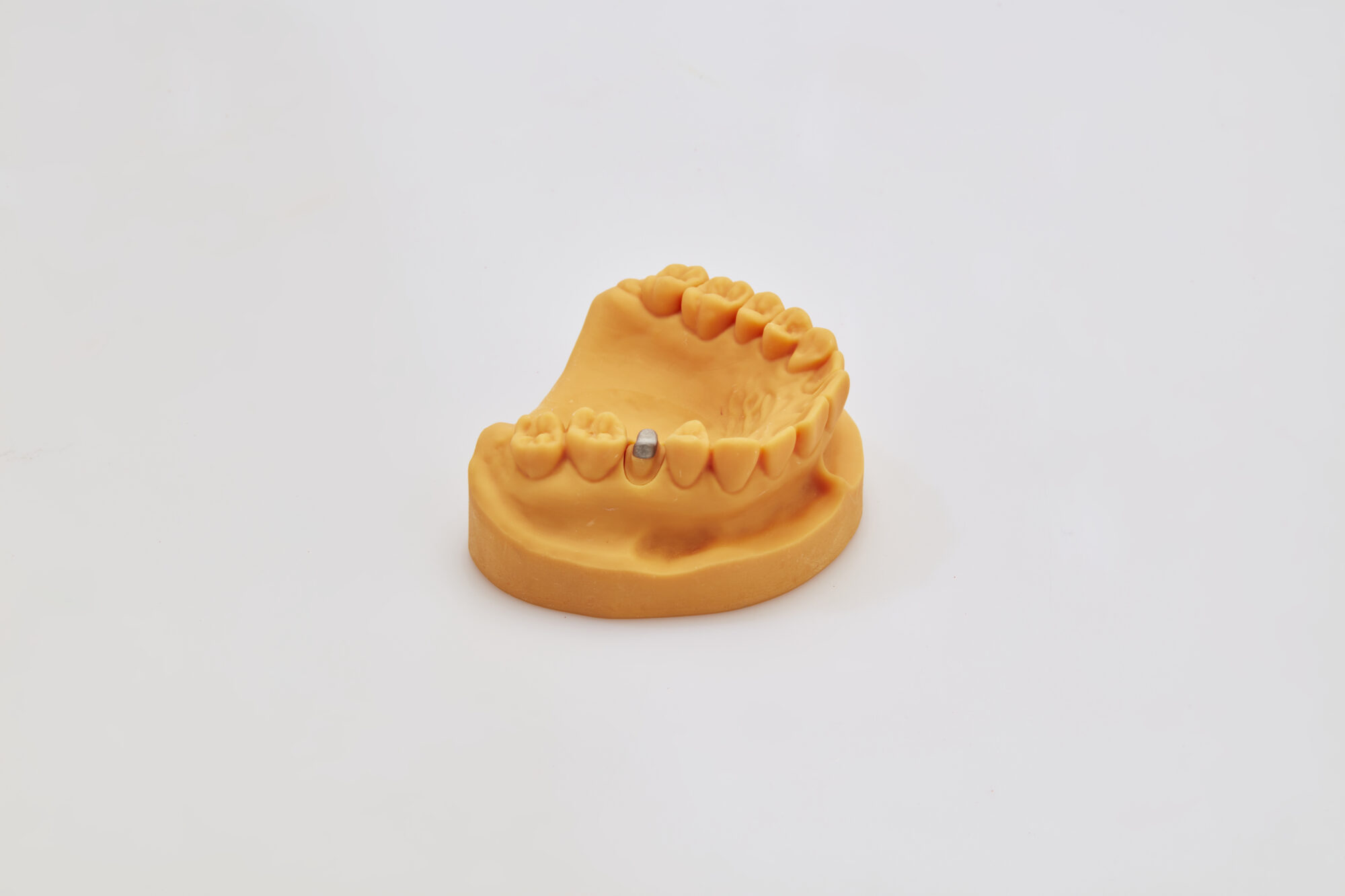 Implant_PNC_Andent_0268