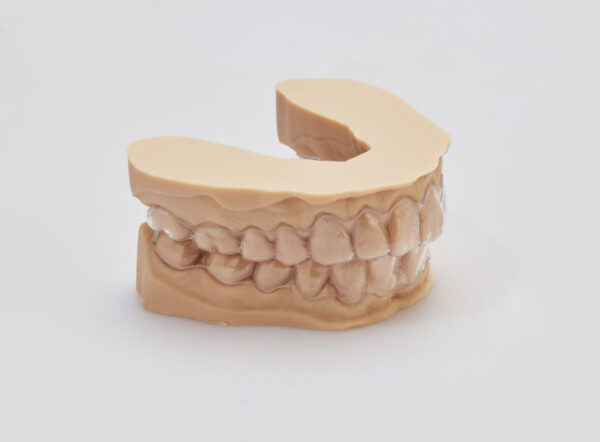 Orthodontic Retainer - Andent - Andent Dental Laboratory