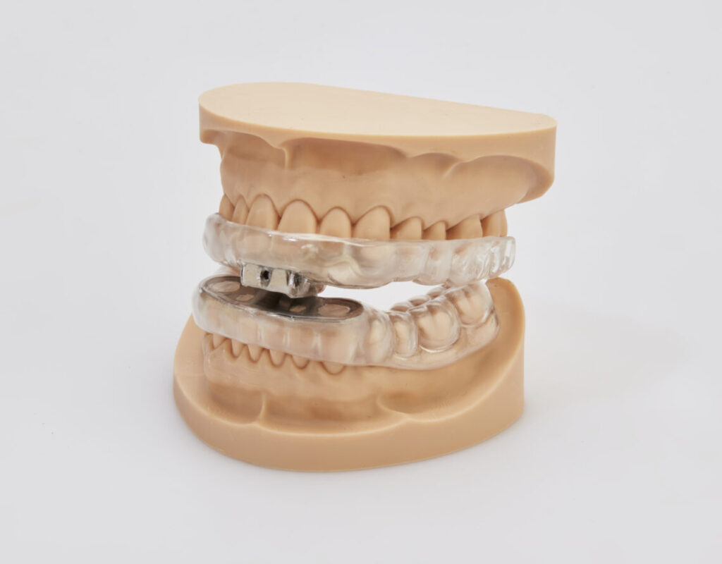 Snore Appliance - Andent - Andent Dental Laboratory