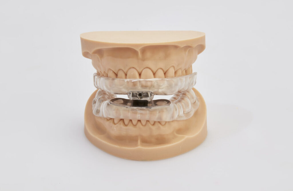 Snore Appliance - Andent - Andent Dental Laboratory